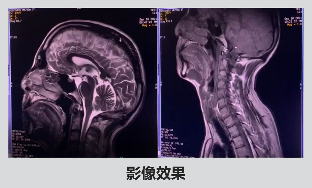2b  科莱瑞迪MR床板改造 海南省肿瘤医院方案 影像效果副本.jpg